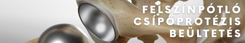 felszínpótló csípőprotézis